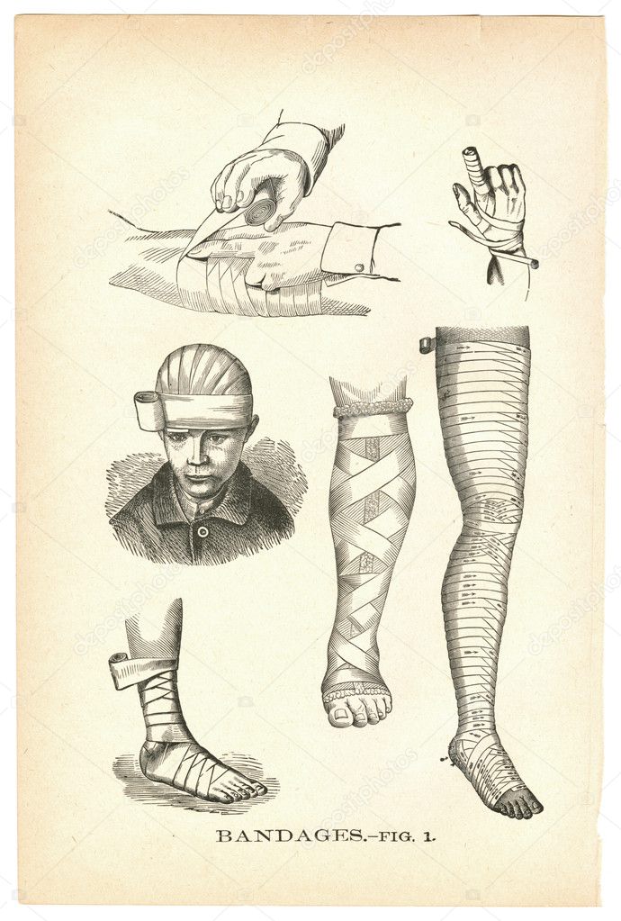 Illustrations of bandaged injuries from a vintage medical book