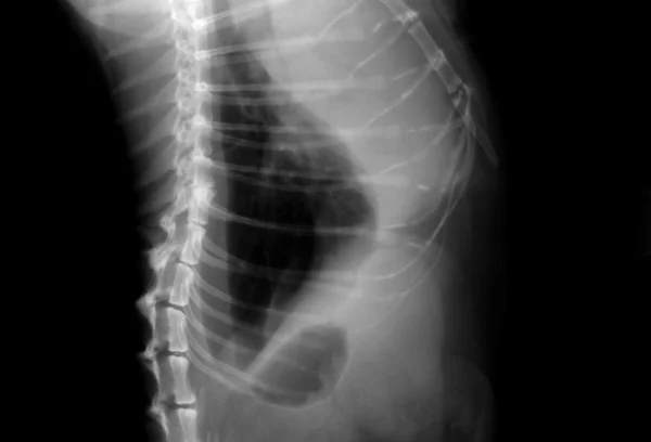 stock image Cat Xray (Lungs)