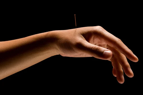 Akupunktur — Stok fotoğraf