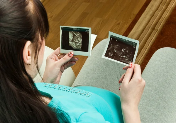 Woman with ultrasound pictures — Stock Photo, Image